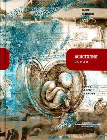 Асистолия Асистолия